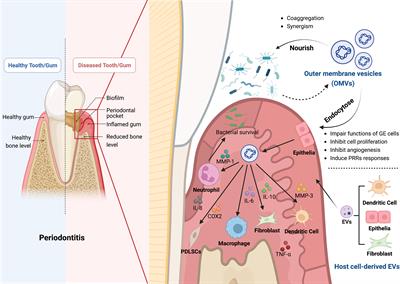 The role of extracellular vesicles in periodontitis: pathogenesis, diagnosis, and therapy